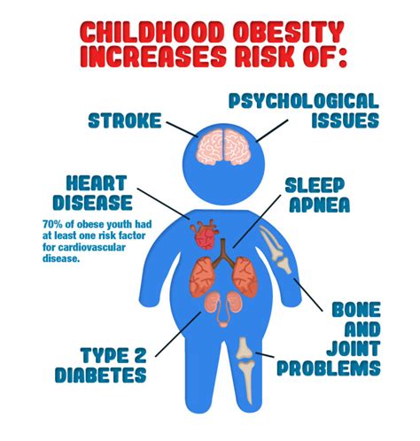 aubrey childhood obesity physical effects